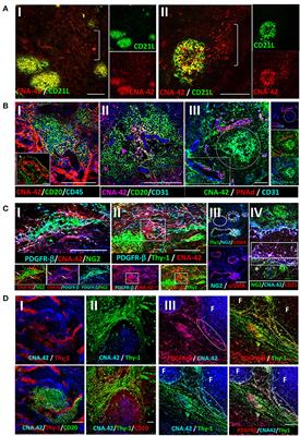 Follicular dendritic cell differentiation is associated with distinct synovial pathotype signatures in rheumatoid arthritis